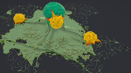 MD Anderson's SPACER Finds Mucins May Block T Cells from Tumors