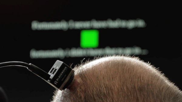 Paralyzed Individual Communicates via Brain Implant, Synthesized Speech and Singing