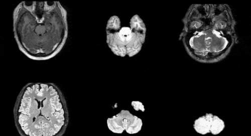Article image for NVIDIA Launches Open-Source AI Model That Generates High-Resolution 3D Brain MRIs 33x Faster Than Previous Technology