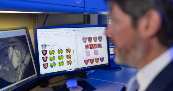 UK researcher spearheads machine learning initiative to model heart fibrosis